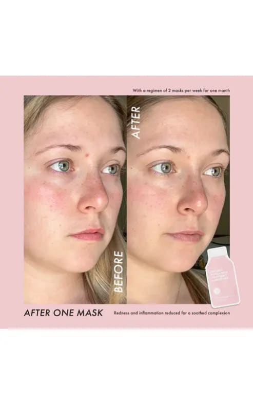 ESW Beausty- Strawberries & Cream Soothing Raw Juice Mask